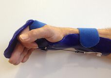 Unsere Handtherapie